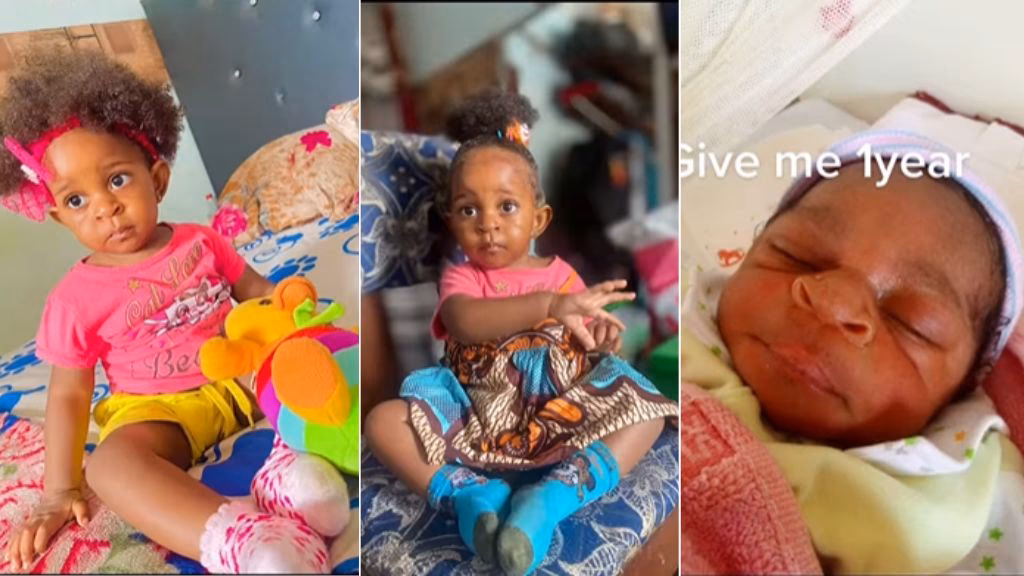 Why does my baby's nose look big?