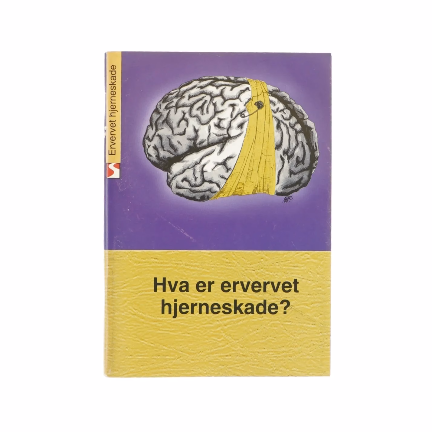 Hvad er tegn på hjerneskade?